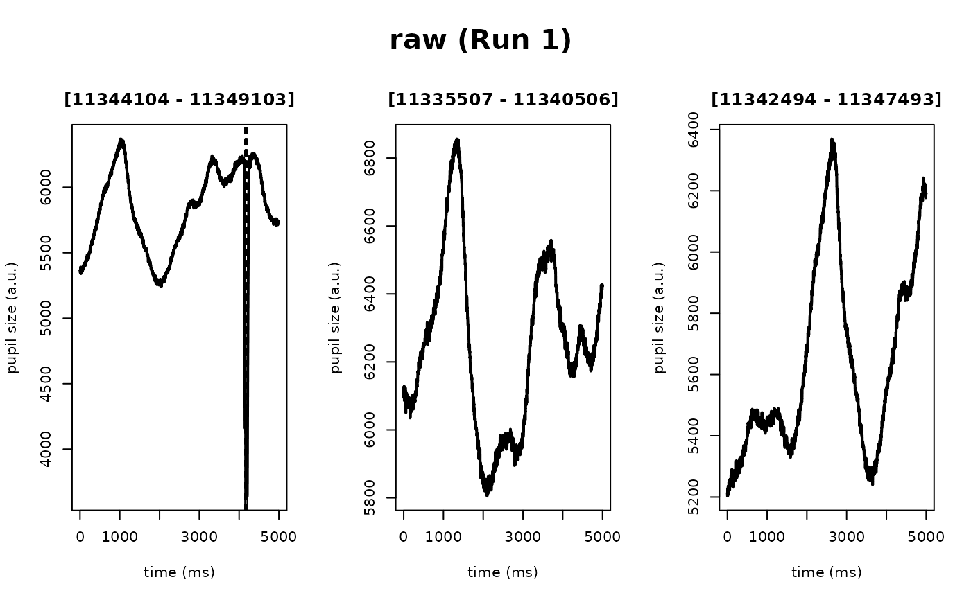Before/after plot showing blink removal and interpolation